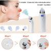 Face Acne Black Dot Pimple Blackhead Remover Electric Microcrystalline Blackhead Vacuum Cleaner Pore Blackhead Skin Care Machine