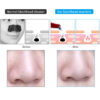 Microcrystalline Facial Deep Pore Cleansing Blackhead Acne Vacuum Suction Cleaner Black Spot Blackhead Remover Pimple Removal