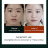 Electric V-Face Shaping Massager Lifting Neck Anti-Wrinkle Red Blue-Ray Double Chin Shaping Beauty Instrument with RemoteControl